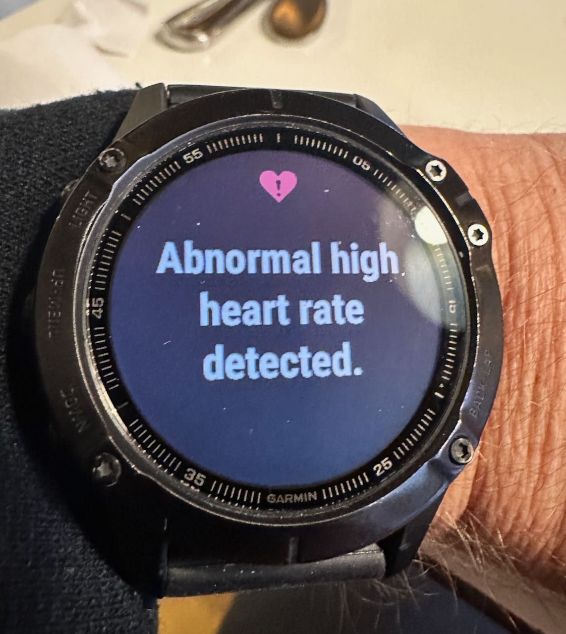 Abnormal heart rate detection on my watch (it happens often when I run - some setting I think)